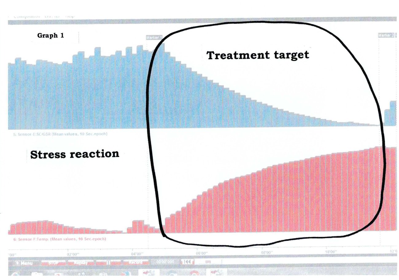 BioTrace session record 1: The treatment target — skin conductance and peripheral temperature traces